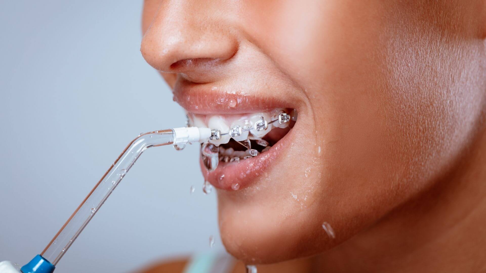 Oral Hygiene